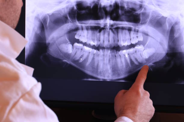 Best Emergency Gum Treatment in Claude, TX