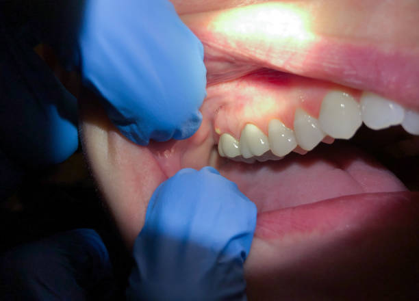 Best Weekend Emergency Dentist in Claude, TX