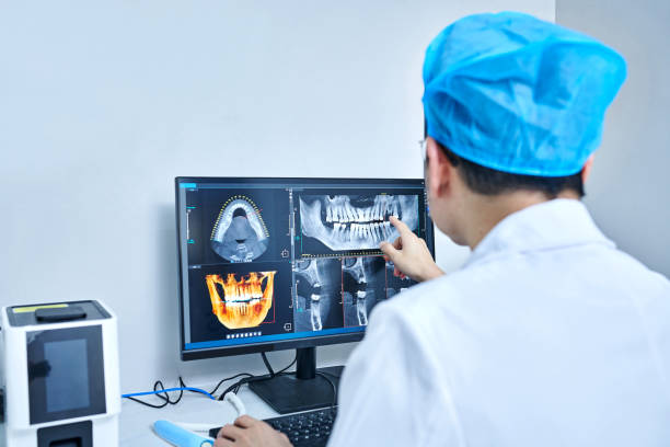 Best Emergency Wisdom Teeth Removal in Claude, TX