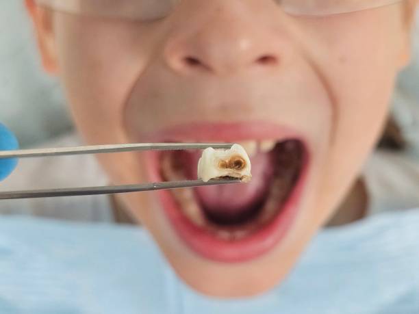 Best Cosmetic Emergency Dentistry in Claude, TX